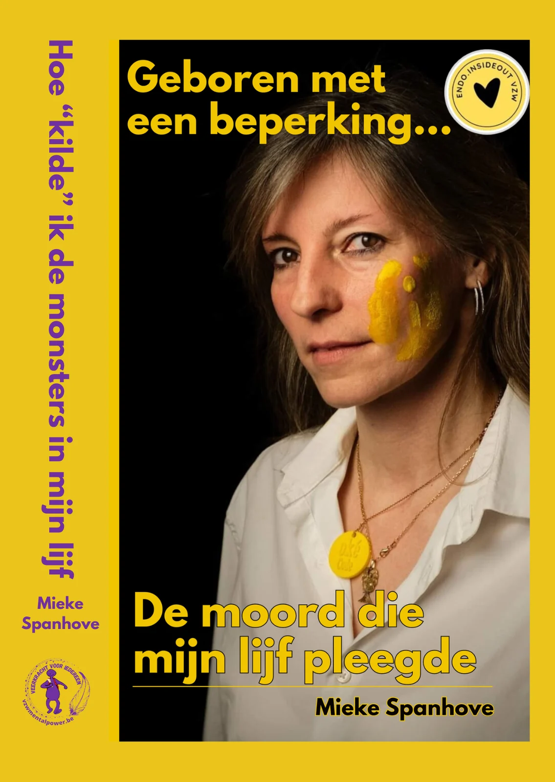 Productafbeelding van Geboren met een beperking, hoe ‘kilde’ ik de monsters in mijn lijf